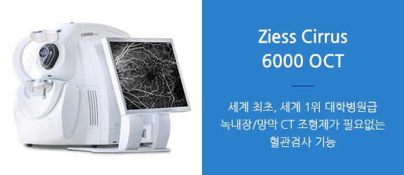 녹내장 정밀진단 및 치료